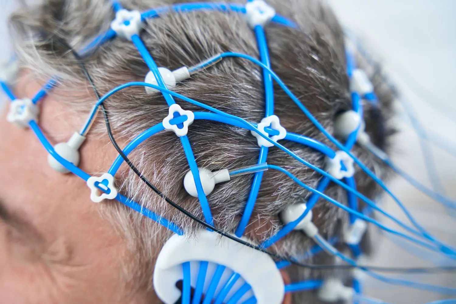 Neurointerfejsy konsumenckie: obecne możliwości i perspektywy